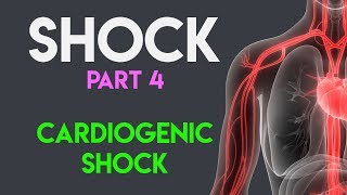 Cardiogenic Shock  Shock Part 4 [upl. by Rizzo]