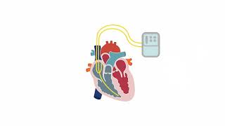 Assessing tricuspid valve stenosis [upl. by Killigrew90]