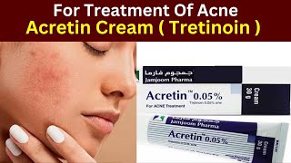 Acretin cream how to use  Acretin 005 cream review  Tretinoin cream  benefits  acne [upl. by Ydnyl]