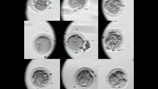 Evolución embriones FIV Embryoscope [upl. by Naaman]