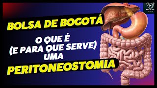 Para que serve uma peritoneostomia [upl. by Annagroeg575]