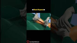 Heart Bypass Surgery Procedure  3D video  cardiology short [upl. by Malinda]