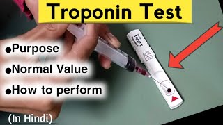 Troponin Test in Hindi  Trop T test Method troponintest nursingcriteria [upl. by Teresina225]