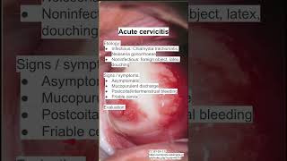 Acute cervicitis [upl. by Cori767]