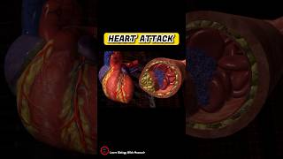 Heart attack short animation  Heart attack cause  cardiology shorts [upl. by Jocko]