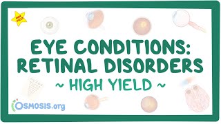 Eye conditions  Retinal disorders Pathology review [upl. by Dreeda]