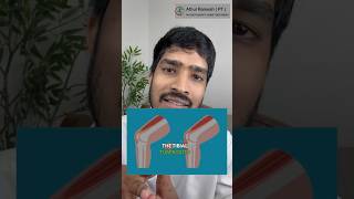 Osgoodschlatter disease youtube youtubeshorts health trending physiotherapy shorts medical [upl. by Aronaele]