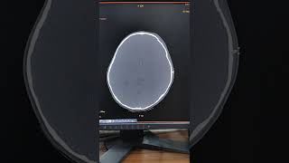 Crazy CT SCAN Shows What a Brain REALLY Looks Like Without Contrast [upl. by Fielding422]