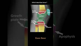 Bone Anatomy knee example 1 Musculoskeletal Xray  General principles radiologychannel007 [upl. by Ettevets]