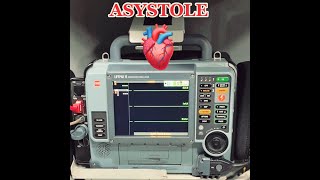 Asystole in EMS  Cardiac Rhythms  ParamedicEMS Cardiology [upl. by Balfour]