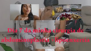 Diário do 7 dia pós abdominoplastia lipoenxertia [upl. by Menedez]