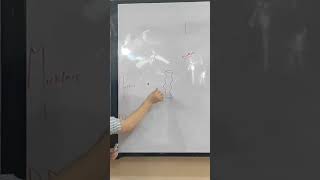 mickels diverticulum anatomy doctor medicalstudent surgery طبــ بشرى  ثانوية عامة [upl. by Page]