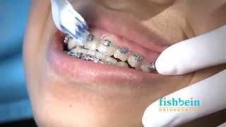 Orthodontic Home Care Instructions  Braces  Brushing [upl. by Rame140]