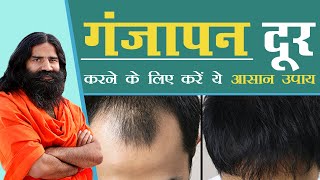 गंजापन दूर करने के लिए करें ये आसान उपाय  Swami Ramdev [upl. by Ilehs]