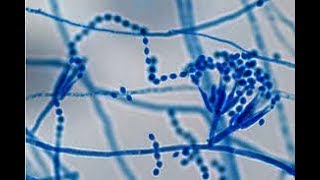 Paecilomyces colony morphology on CMA and LPCB tease mount Microscopy [upl. by Rebel]