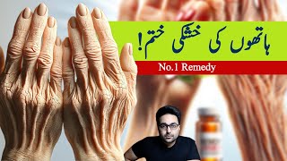 Dr Zee1 Absolute Best Remedy for Dry and Wrinkled Hands उत्तम उपाय [upl. by Lepine]