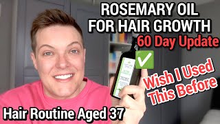 ROSEMARY OIL FOR HAIR GROWTH  Nature Spell Rosemary Oil Review [upl. by Evan377]