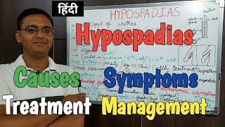 Hypospadias Causes Symptoms Treatment Management RinkeshPariyani PathoPharma [upl. by Placida]