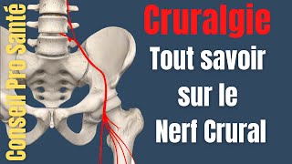 Cruralgie  Quest ce que le nerf crural  nerf fémoral [upl. by Gilbert]