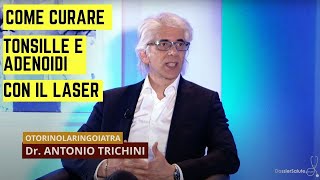 Tonsille e adenoidi come curarle con la chirurgia laser  Dott Antonio Trichini [upl. by Yarazed]