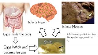 Neurocisticcircosis symptoms and treatment Why is pork tapeworm so dangerous [upl. by Eerat]