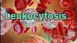 Leukocytosis  Definition of leukocytosis  Type of leukocytosis  Causes of leukocytosis💯 [upl. by Segal800]