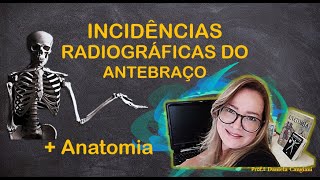 🎥Vídeo 07🎬 Incidências Radiográficas do Antebraço  Anatomia [upl. by Zelma]