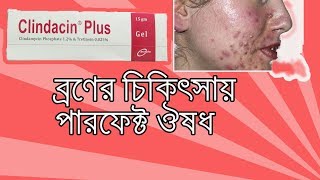 Clindacin Plus Gel  what is clindamycin gel used to treat Bangla [upl. by Aener46]