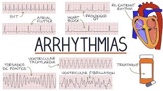 Hospital Training  Internal medicine  Arrhythmias Dr Mohammed Mahdi 20242025 [upl. by Neill]