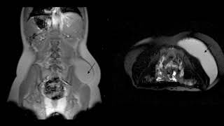 Difference Between Hyperventilation and Tachypnea [upl. by Lilian]