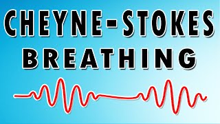 Breathing in Waves Understanding CheyneStokes Respiratory Rhythm [upl. by Kohler771]