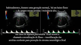 DOPPLER OBSTÉTRICA FETAL  ARTÉRIA CEREBRAL MÉDIA  CLÍNICA SARRAFF CURITIBA  PARTE 4 [upl. by Genevra892]