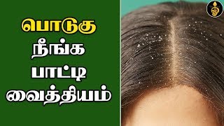 Podugu thollai neenga tips Tamil  பொடுகு நீங்க பாட்டி வைத்தியம்  Podugu povathu eppadi  Dandruff [upl. by Treat]