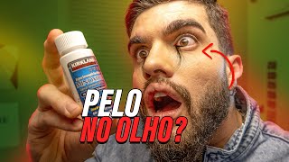 Efeitos COLATERAIS do MINOXIDIL  VERDADE OU MITO [upl. by Perkoff]