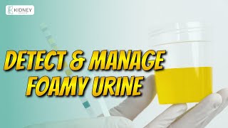 How To Measure Foam In Urine  Effective Tips To Manage Foamy Urine  Proteinuria [upl. by Merci]