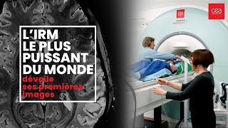 🧠Première mondiale Le cerveau dévoilé comme jamais grâce à l’IRM le plus puissant au monde [upl. by Alleb980]