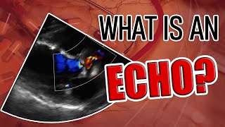 What is an Echocardiogram [upl. by Carolina]