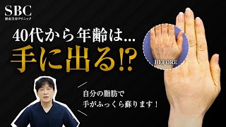 【4050代女性必見！手の老け感改善】手のシワを消す・ふっくら若返らせる方法をご紹介！マッサージでは治らなかった人でも安心！【湘南美容クリニック】 [upl. by Cicily]