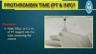 PT Prothrombin Time and INR Test Procedure [upl. by Yatnuahs]