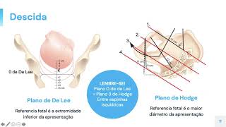 Revisão mecanismo de parto [upl. by Karlotte]