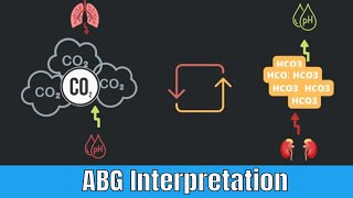 CO2 Retention PaCO2 ABG analysis [upl. by Rehc]