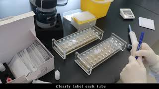 Cryptococcal rapid test Lateral Flow Assay  Era Biology [upl. by Olegnad975]