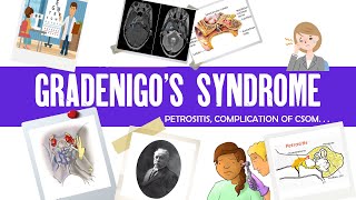 Gradenigo syndrome  Petrositis  Complications of CSOM  Ear disease  ENT [upl. by Hirst822]