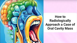 How to radiologically approach a case of oral cavity mass By Prof DrAyda Youssef [upl. by Good771]