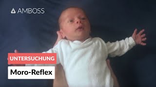 MoroReflex  Frühkindliche Reflexe  AMBOSS Video [upl. by Doomham]