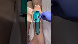 Professional lower leg wax using blue hard wax from Starpil hairremoval waxingexpert [upl. by Garik]