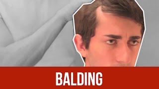 BALDING  FACE IT [upl. by Dougie]