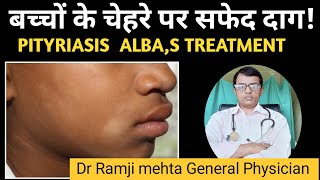 White Patch on Face  Is This Vitiligo or Pityriasis Alba बच्चों के चेहरे पर सफेद दागDr Ramji [upl. by Maccarone836]