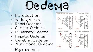 Oedema Pathology [upl. by Anastas]