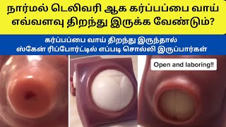 cervix dilation  cervical effacement  cervix dilation chart  cervix dilation symptoms in tamil [upl. by Assinna]